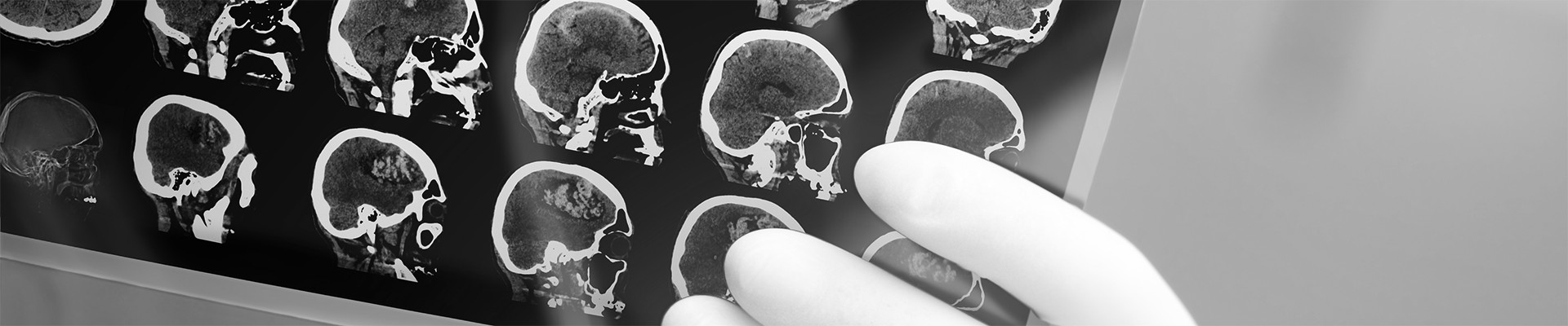 diagnostica per immagini